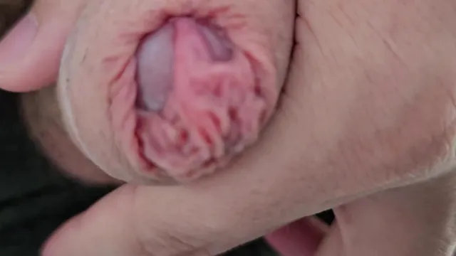 Close call as MyPenisIsDifferent plays with a rare uncut cock